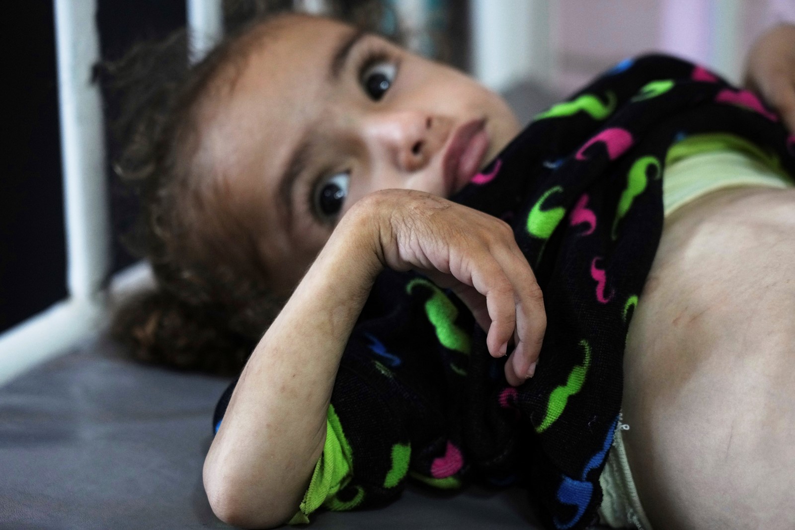 Mideast_Wars_Gaza_Malnutrition_75481--db2a2_1093413281.jpg