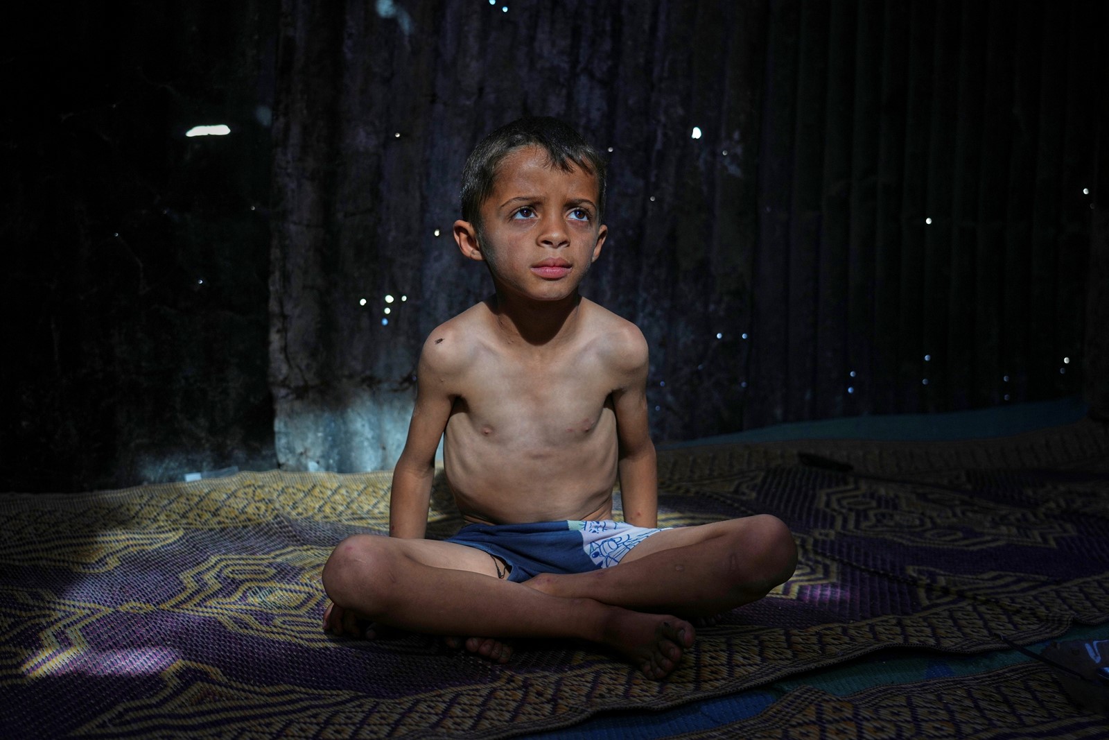 Mideast_Wars_Malnourished_Children_05241--26321_1092683967.jpg