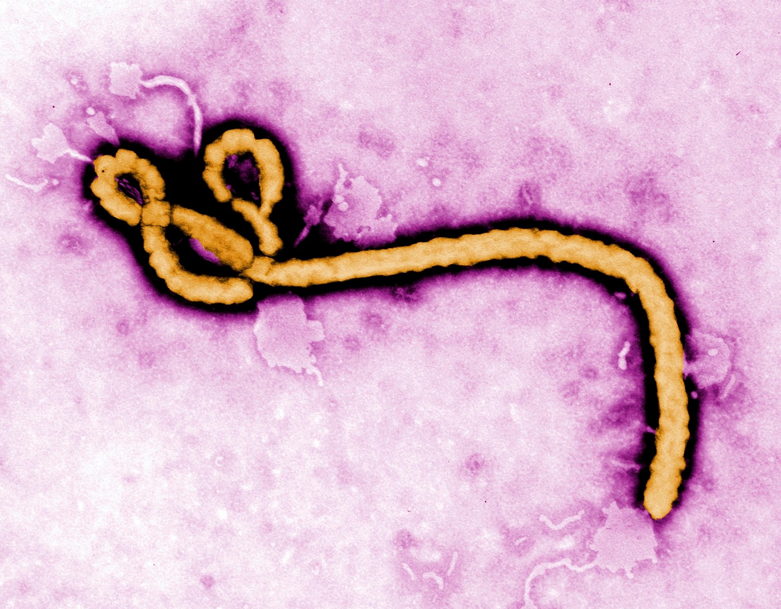 Congo_Ebola_1624_--69fdb_1106752518.jpg