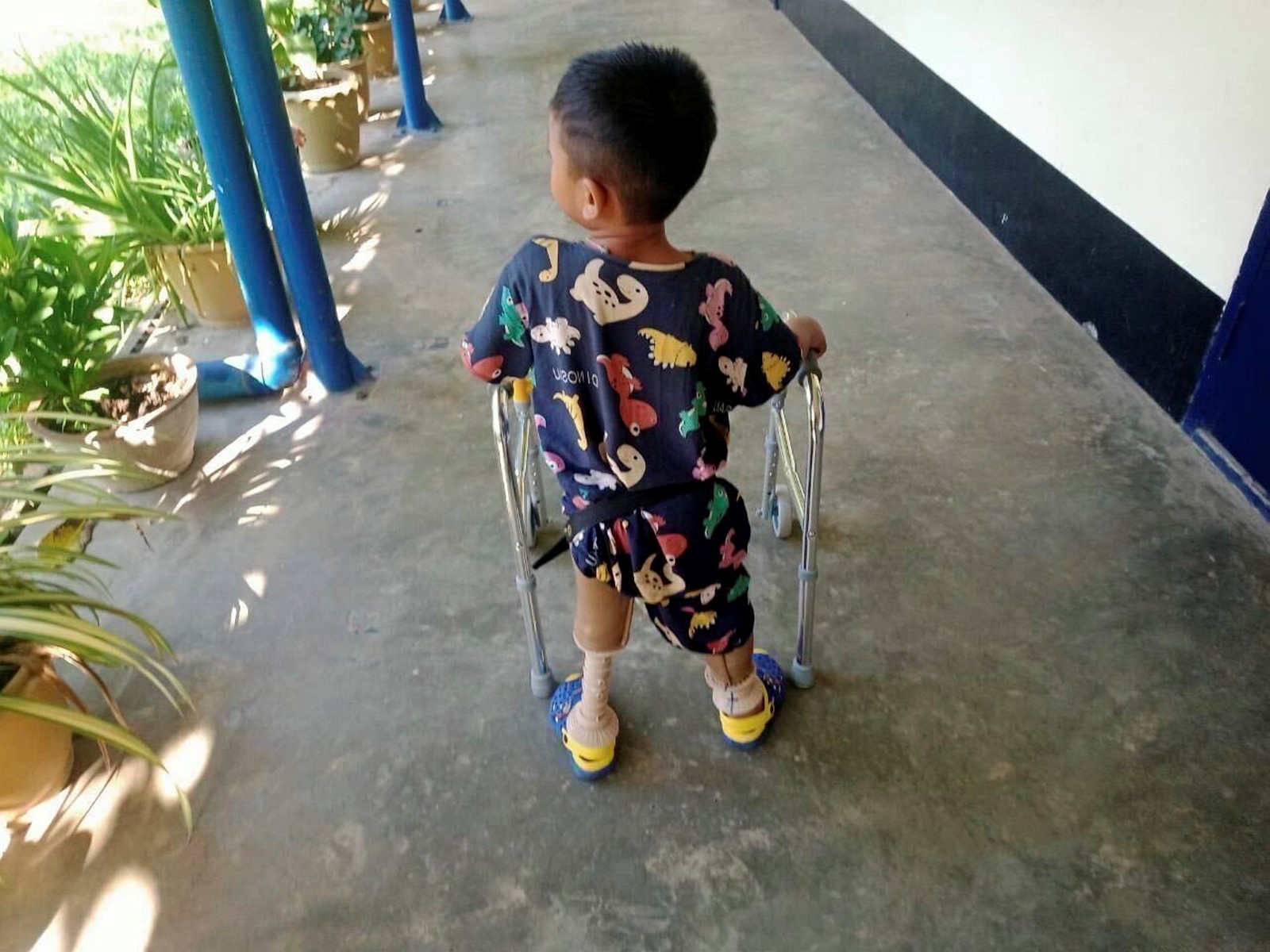 Myanmar_Landmines_12450--ab1bd_1059843712.jpg