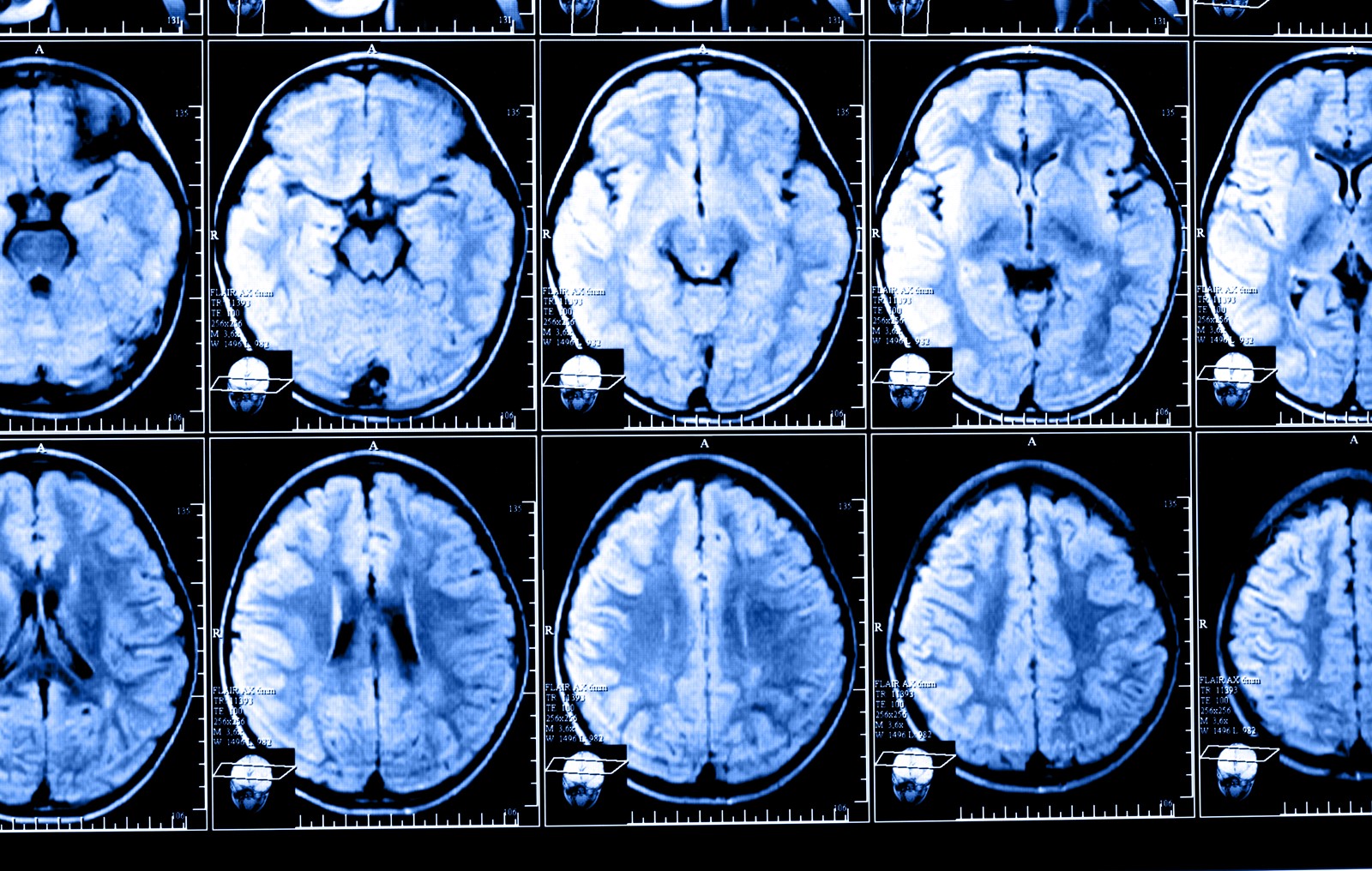 SJM-L-BRAINS-0501-01_1078127481.jpg